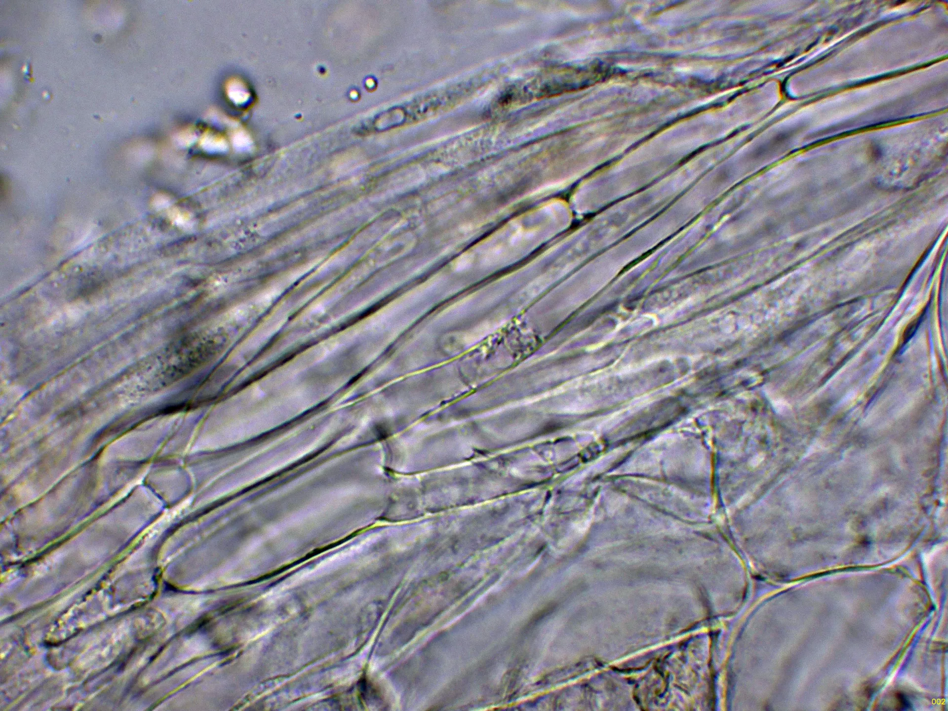 Microscopía de Mycena zephirus - 10 - Suprapellis agua-002